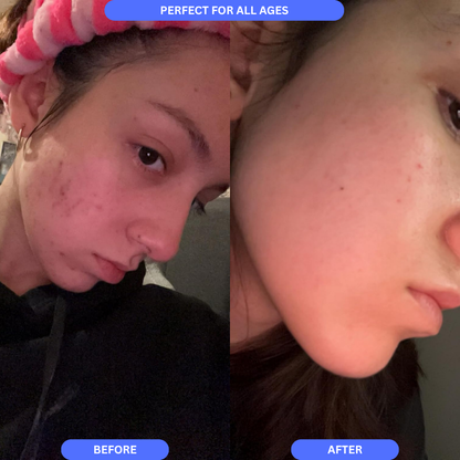 Scarheal Pro™