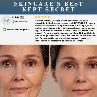 SilkLift Pro™